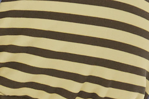 Juni Bikini Top | Yellow Stripe - Image 9